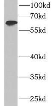 IFIT3 Rabbit Polyclonal Antibody