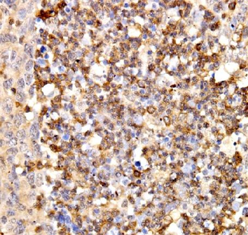 IFIT3 Rabbit Polyclonal Antibody