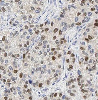 IFITM2 Rabbit Polyclonal Antibody
