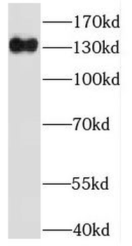 IFT122 Rabbit Polyclonal Antibody
