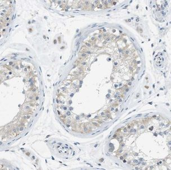 IFT122 Rabbit Polyclonal Antibody