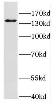 IFT140 Rabbit Polyclonal Antibody