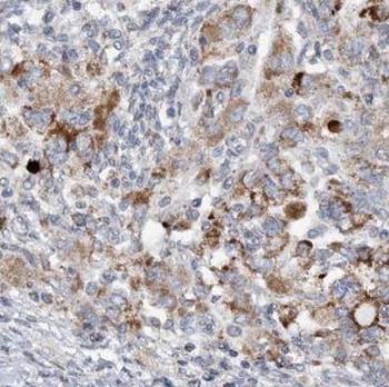 IFT20 Rabbit Polyclonal Antibody