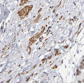 IFT57 Antibody
