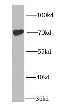 IGF2BP1 Antibody