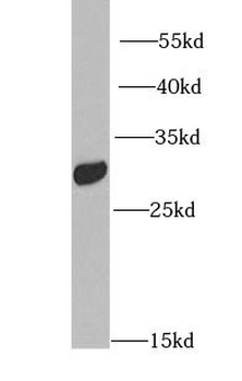 IGFBP5 Antibody