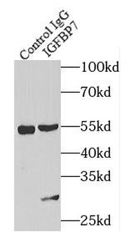 IGFBP7 Antibody