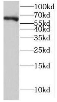 IGHD Rabbit Polyclonal Antibody