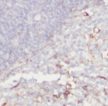 IGHD Rabbit Polyclonal Antibody