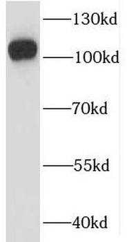 IGHMBP2 Rabbit Polyclonal Antibody