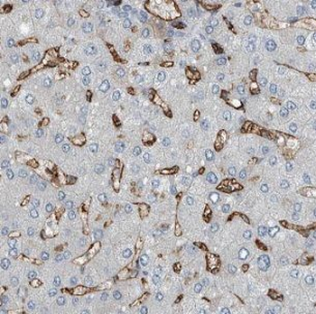 IGHMBP2 Rabbit Polyclonal Antibody