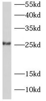 JCHAIN Rabbit Polyclonal Antibody