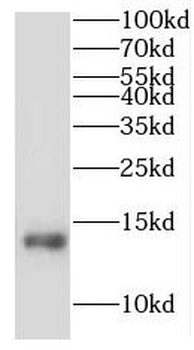 IGKV1 5 Rabbit Polyclonal Antibody