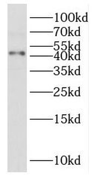 IGSF11 Rabbit Polyclonal Antibody