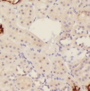 IGSF11 Rabbit Polyclonal Antibody