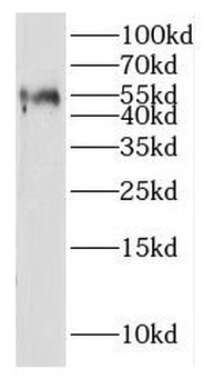 IGSF21 Rabbit Polyclonal Antibody