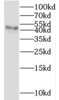 IHH Rabbit Polyclonal Antibody