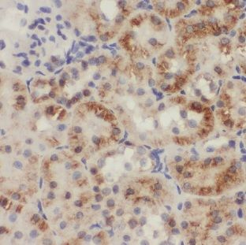 IHH Rabbit Polyclonal Antibody