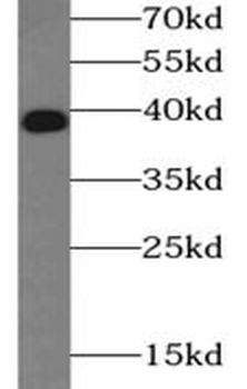 NFKBIA Rabbit Polyclonal Antibody