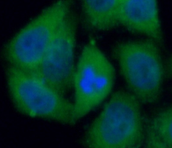 NFKBIA Rabbit Polyclonal Antibody