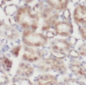 NFKBIA Rabbit Polyclonal Antibody