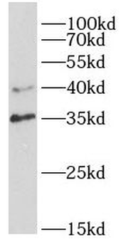 NFKBIA Rabbit Polyclonal Antibody