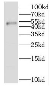 IKZF1 Antibody
