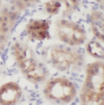 IL12A Antibody