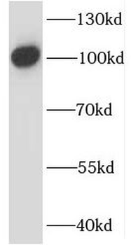 IL12RB1 Antibody