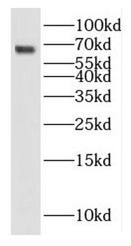 IL13RA2 Antibody