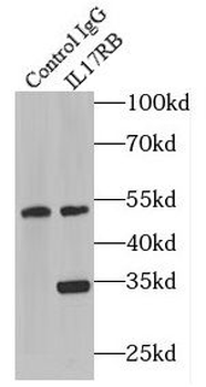 IL17RB Antibody