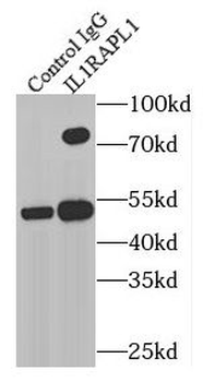IL1RAPL1 Antibody
