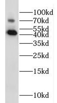IL20RB Antibody
