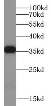 IL20RB Antibody