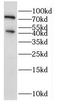 IL5RA Rabbit Polyclonal Antibody