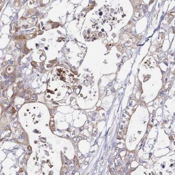 IL5RA Rabbit Polyclonal Antibody