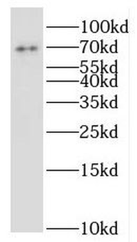 ILVBL Rabbit Polyclonal Antibody