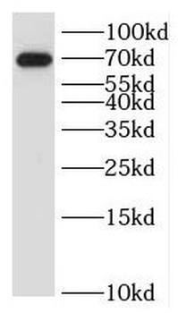 ILVBL Rabbit Polyclonal Antibody