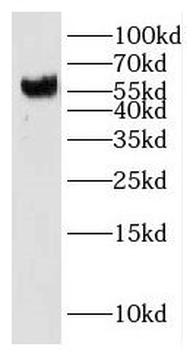 IMPDH2 Rabbit Polyclonal Antibody