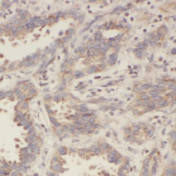 IMPDH2 Rabbit Polyclonal Antibody