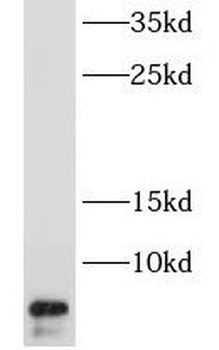 INE1 Rabbit Polyclonal Antibody