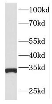 ING2 Rabbit Polyclonal Antibody