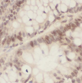 ING2 Rabbit Polyclonal Antibody