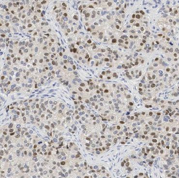 ING3 Rabbit Polyclonal Antibody