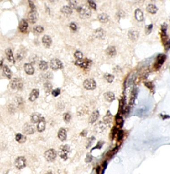 ING4 Rabbit Polyclonal Antibody