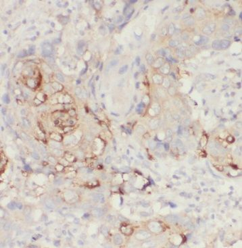INHBA Rabbit Polyclonal Antibody