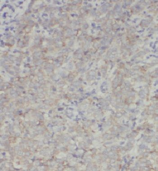 INO80C Rabbit Polyclonal Antibody