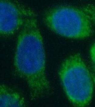 NOS2 Rabbit Polyclonal Antibody