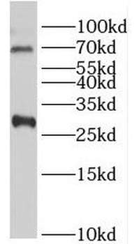 INSIG1 Rabbit Polyclonal Antibody