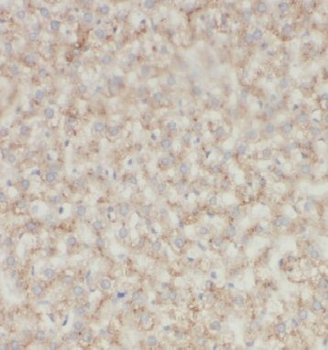 INSIG1 Rabbit Polyclonal Antibody